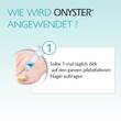 Onyster Nagelset - 4