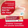 Soventol® Hydrocortisonacetat 0,25% Cremogel bei Hautentz&uuml;ndungen - 2