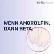 Amorolfin beta 50 mg/ml wirkstoffhaltiger Nagellack - 6