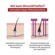 MINOXIDIL DoppelherzPharma 20 mg/ml L&ouml;sung f&uuml;r Frauen - 7