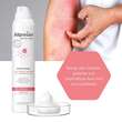 Allpresan derma med Atopix Shower Dusch-Schaum - 4