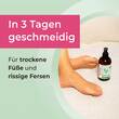 Myfeet by almirall Fu&szlig;pflegecreme - 6