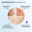 Evolsin Dellwarzen Mittel L&ouml;sung - 2
