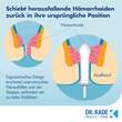 Postericare H&auml;morrhoiden-Stick - 4