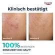 Eucerin Dermopure Clinical Peeling 10 Nachtcreme - 3