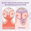 Direxol bei Durchfall Apriwell Hartkapseln - 5