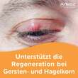 Artelac Augenlidhelfer Salbe - 4