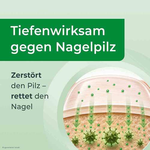 Ciclopoli gegen Nagelpilz mit Applikationshilfe - 5