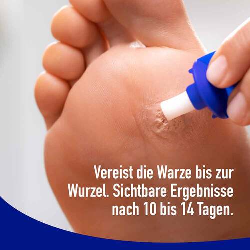 Wartner Fu&szlig;warzen Spray - 5