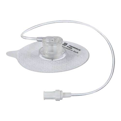 Ambix Intrastick Safe 22 Gx20 mm - 1