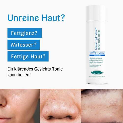 Benevi Hydroderm Gesichts Tonic - 3