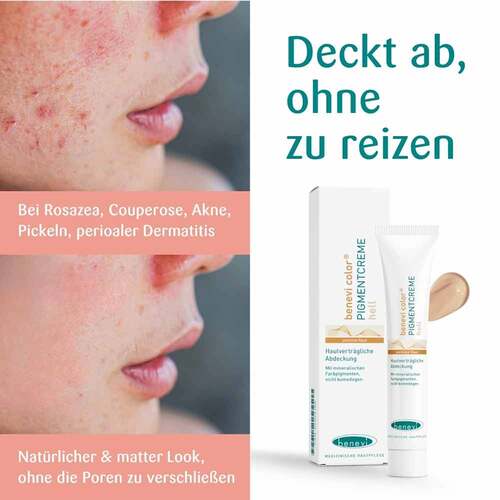 Benevi Color Pigmentcreme hell - 3