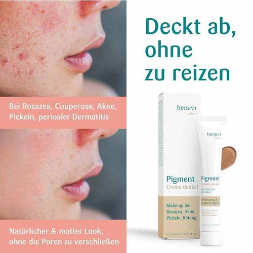 Benevi Color Pigmentcreme dunkel - 3