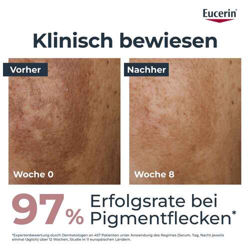 Eucerin Anti-Pigment Dual Serum - Pigmentflecken - 3