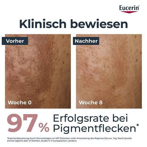 Eucerin Anti-Pigment Tagescreme LSF 30 - 3