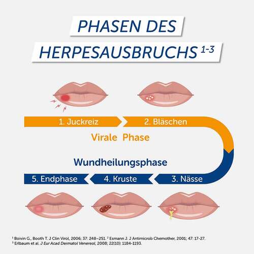 Pencivir bei Lippenherpes Creme - 4