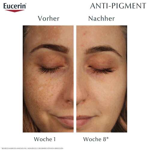 Eucerin Anti-Pigment Nachtcreme - 4