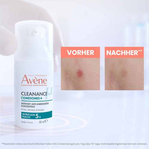 Avene Cleanance Comedomed Anti-Unreinheiten Konzentrat  - 6