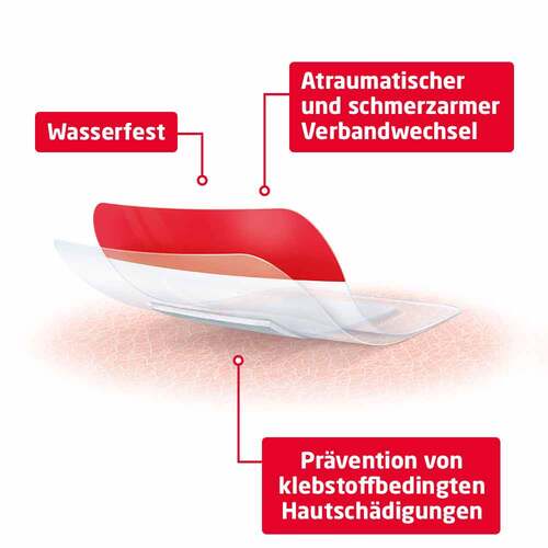 Leukomed® T plus skin sensitive 5x7,2 cm - 4