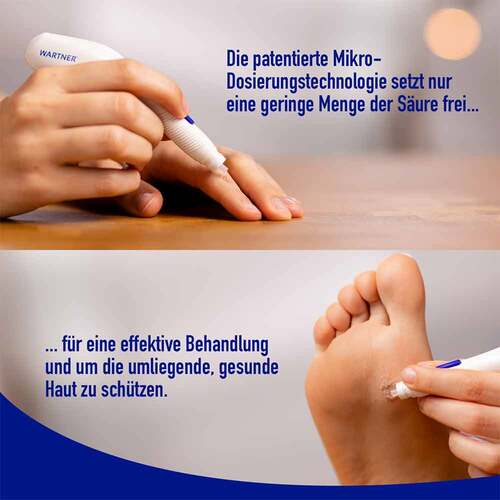 Wartner Stift gegen Warzen 2.0 - 4