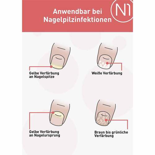 N1 Nagelpilz L&ouml;sung - 4