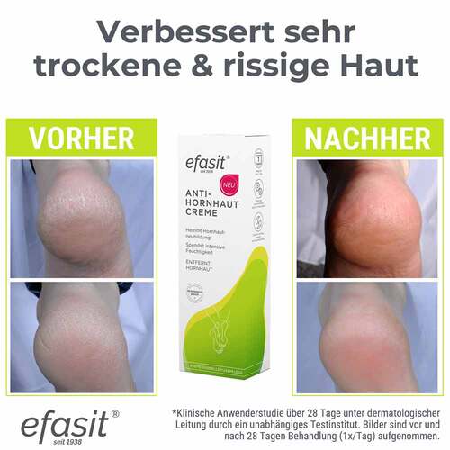 Efasit Anti-Hornhaut Creme - 7
