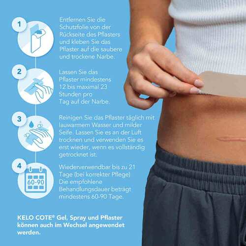 Kelo-Cote Silikon-Narbenpflaster Kaiserschnitt - 5