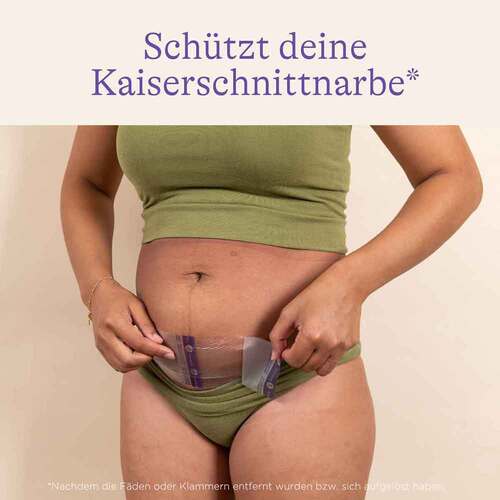 Kaiserschnitt-Hydrogel-Pads - 2