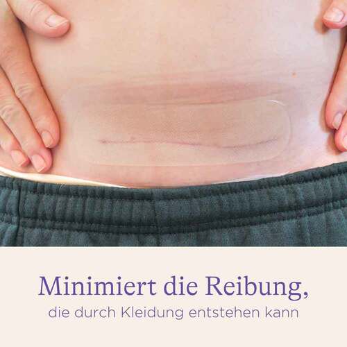 Kaiserschnitt-Hydrogel-Pads - 3