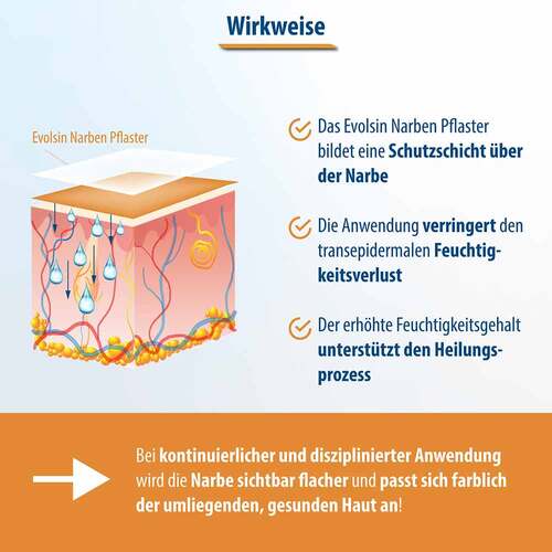 Evolsin Narbenpflaster 2x200 cm - 2