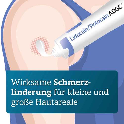 Lidocain / Prilocain ADGC 25 mg / g + 25 mg / g Creme - 2