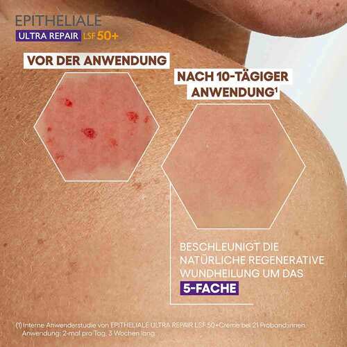 A-Derma Epitheliale Ultra Repair Creme LSF 50 +  - 5