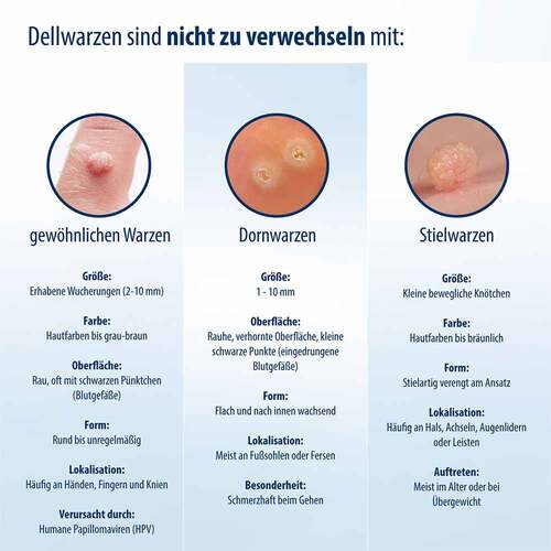 Evolsin Dellwarzen Mittel L&ouml;sung - 3
