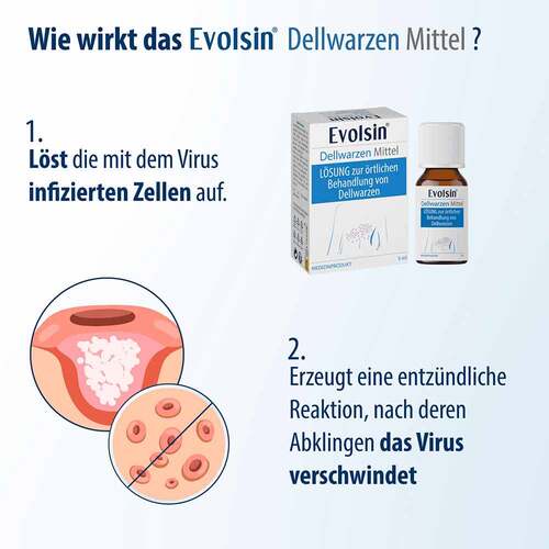 Evolsin Dellwarzen Mittel L&ouml;sung - 7