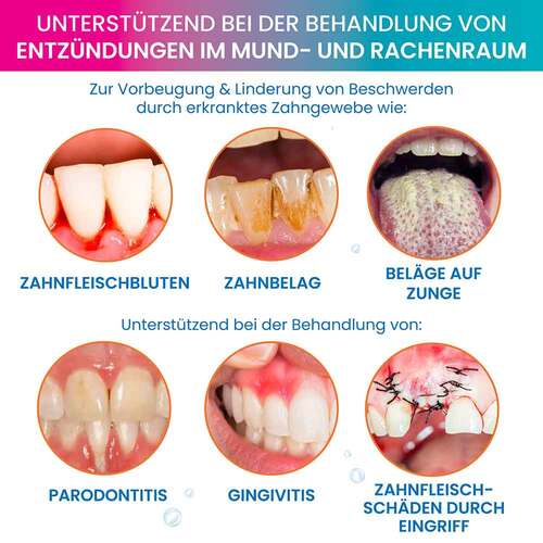 Oroxid Forte Mundsp&uuml;ll&ouml;sung - 3