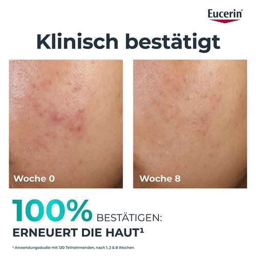 Eucerin Dermopure Clinical Peeling 10 Nachtcreme - 3