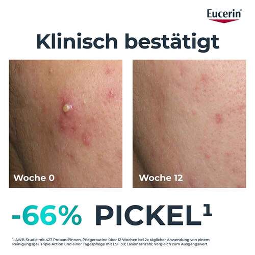 Eucerin Dermopure Clinical Triple Action Creme - 3