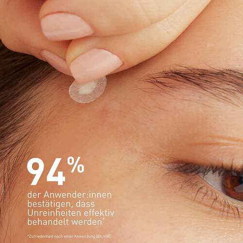 CeraVe Anti-Unreinheiten Patches - 5