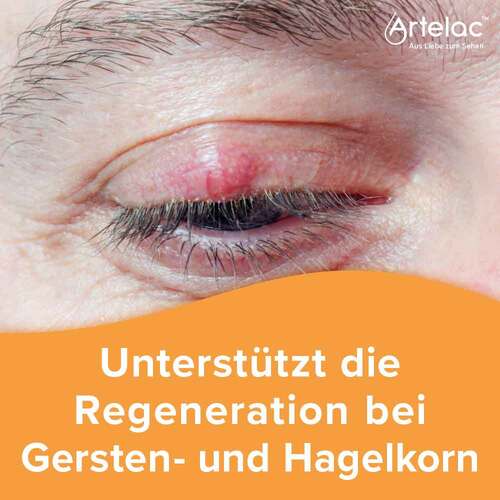 Artelac Augenlidhelfer Salbe - 4